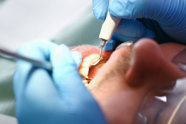 Best Pediatric Emergency Dentist in Alva, FL