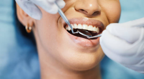Best Emergency Dentist for Knocked-Out Tooth in Alva, FL