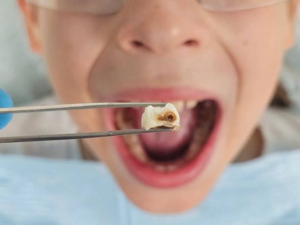Best Pediatric Emergency Dentist in Alva, FL